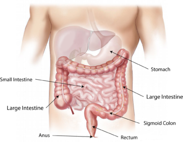 Ulcerative Colitis – It Can Be a Pain in the Butt!