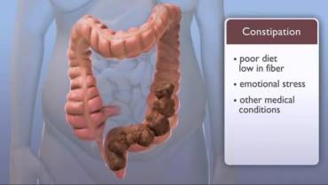 What Constipation Can Do to Your Health